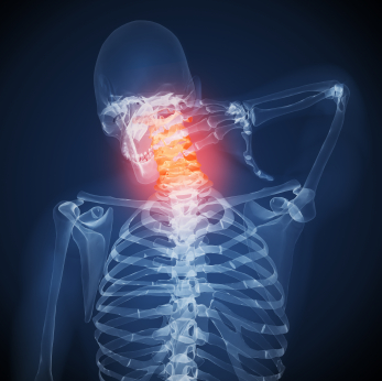 Neck-Pain